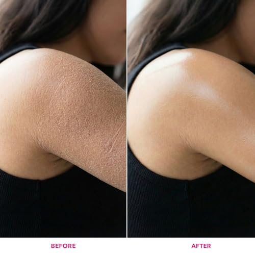 Dabur Gulabari Moisturizing Body Lotion – 400 ml | For Men & Women | Dry Skin Care | With 100% Organic Rose Oil & Shea Butter | Dermatologically Tested | Paraben Free | 72 Hour Moisturisation - Image 6